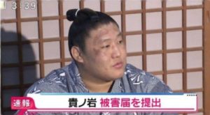 貴ノ岩の画像